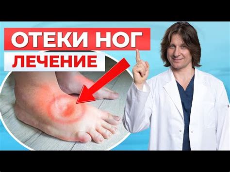 Методы лечения и снятия отека