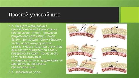 Методы лечения танталовых швов на легких