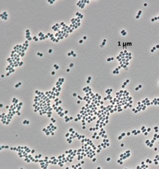 Методы лечения Acinetobacter johnsonii в моче