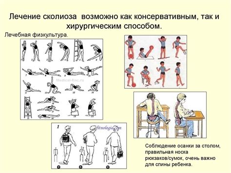 Методы профилактики перекоса позвоночника вправо