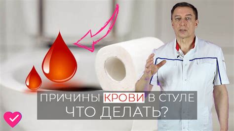 Методы хирургического лечения крови в кале