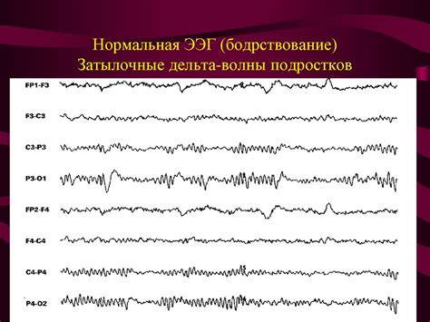 Миографические артефакты на ЭЭГ: суть проблемы и последствия