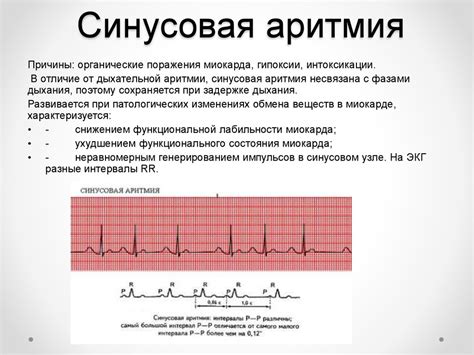 Мир звуков и ритмов сердца