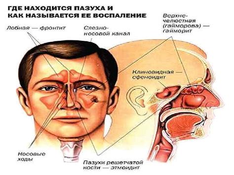 Мифы о грибковом поражении гайморовой пазухи