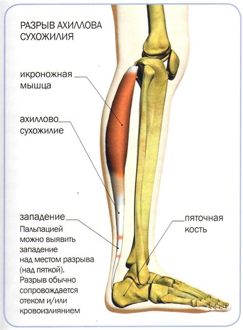 Нагрузка на мышцы и сухожилия