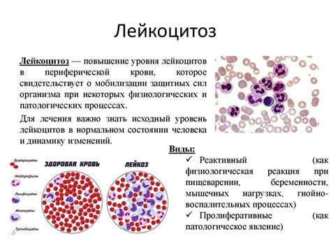 Нарушения кроветворения в организме