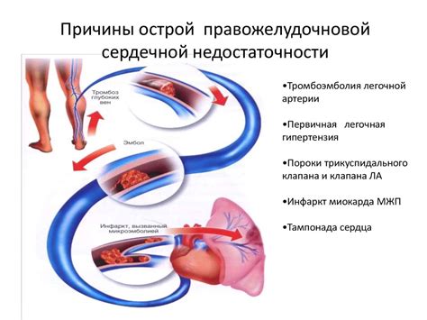 Недостаточность кровообращения: