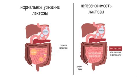 Непереносимость трентала: проблема и решения