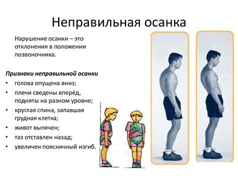 Неправильная осанка и плохая осадка