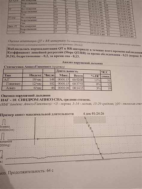 Нормоадаптация QT к RR интервалу: важный процесс для сердечной системы