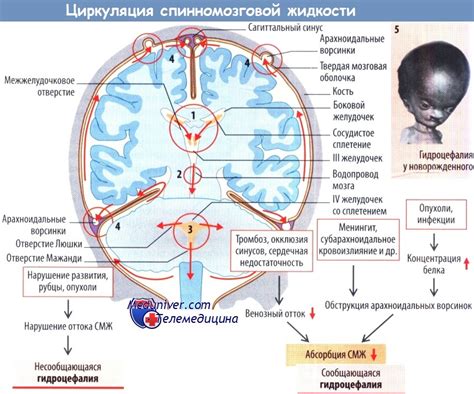 Обеспечение циркуляции и дренажа спинномозговой жидкости