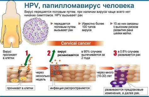 Обнаружение ВПЧ высокого риска: что делать?