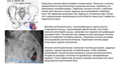 Общие признаки повреждения копчика