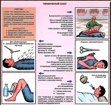 Оказание первой помощи при ожоге кипятком