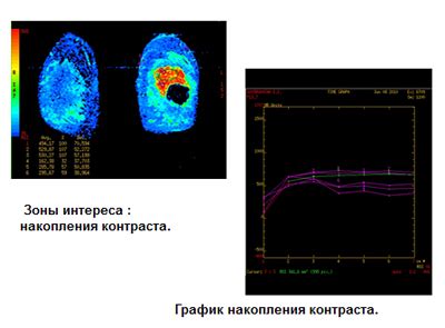 Оксифильные массы в цитологии: