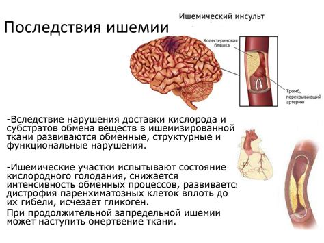 Опасности ишемии: возможные последствия ишемических состояний