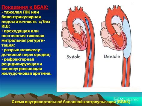 Опасность и последствия экстрасистолии и аритмии