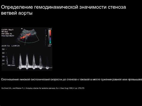 Определение гемодинамического стеноза