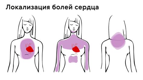 Определение и признаки стонущей боли