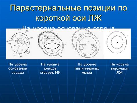 Определение и суть короткой позиции