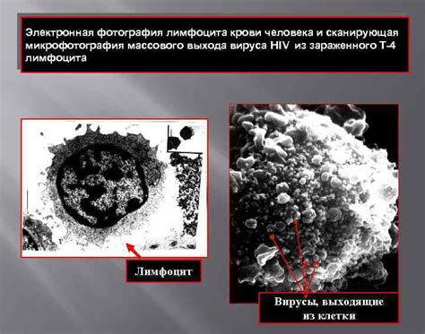 Определение и характеристика вируса HIV в медицине