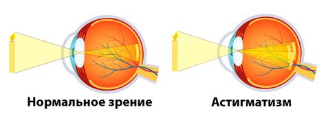 Определите ось астигматизма