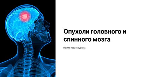 Опухоли головного и спинного мозга: симптомы и диагностика