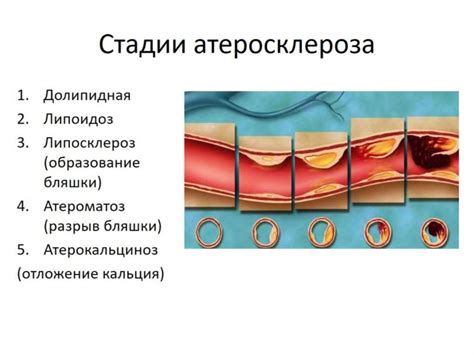 Ослабление сосудистой стенки