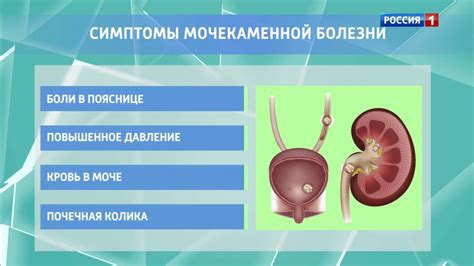 Осложнения движения камня в почках