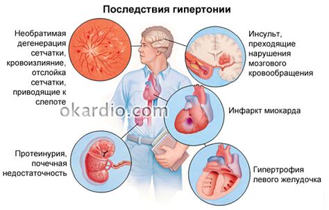 Основные причины гипертонии 3 степени