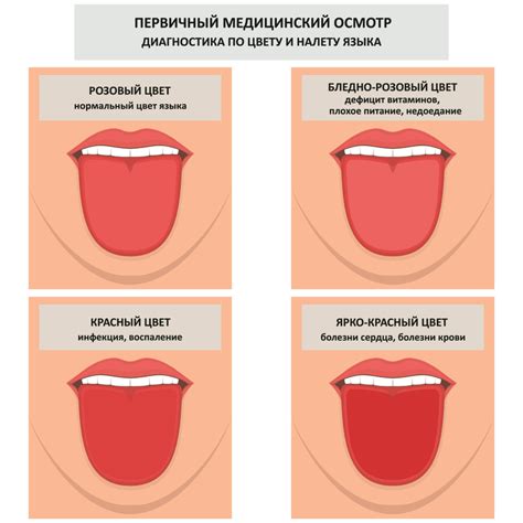 Основные причины крови на языке