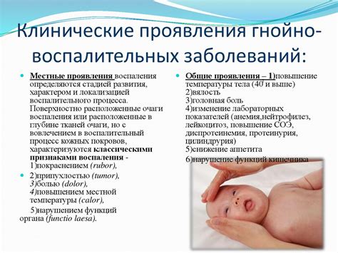 Основные симптомы синдрома ВДС и их проявление у новорожденных