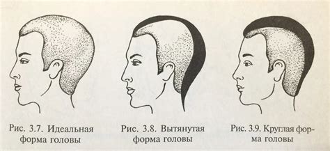 Основные типы форм черепа