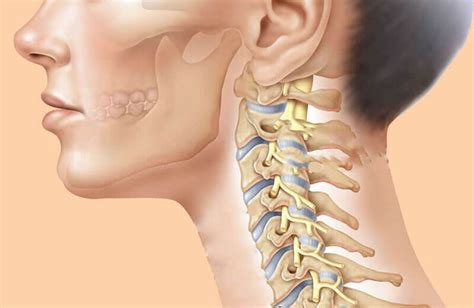 Особенности СКТ шейного отдела позвоночника
