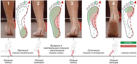 Особенности строения стопы, влияющие на съезжание кроссовок