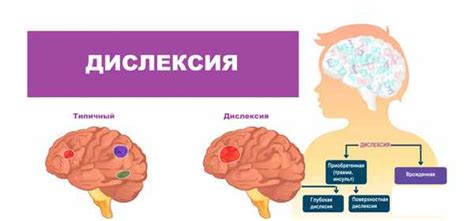 Отличия фонематической дислексии от других видов дислексии