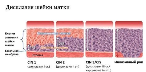 Отсутствие клеток с признаками атипии: проблема или плюс?