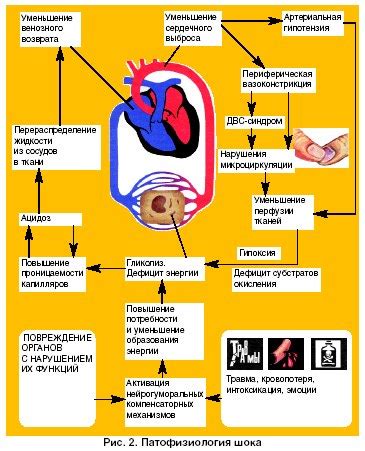 Очередь сердечно-сосудистой недостаточности