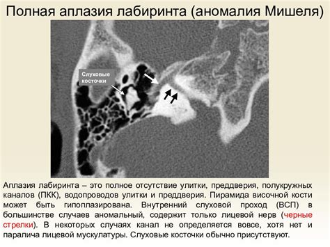 Патологии внутреннего уха