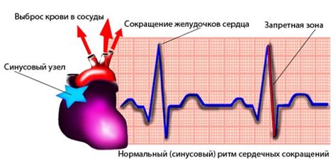 Перебои в сердечном ритме: что это значит?