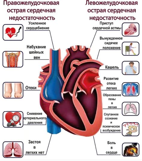 Перегрузка сердца и возникновение сердечной недостаточности