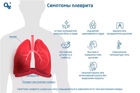 Плеврит и его симптомы