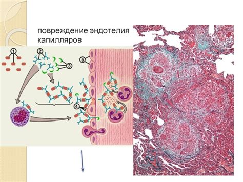 Повреждение капилляров