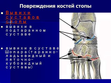 Повреждение костей и суставов