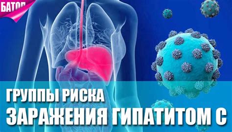 Повышение риска заражения вирусом гепатита A