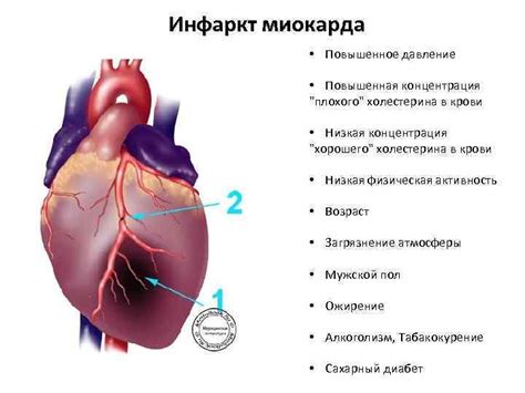 Повышенная потребность миокарда в крови: