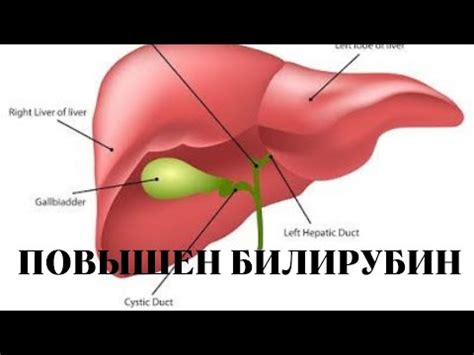 Повышенный билирубин в крови: причины, симптомы, лечение