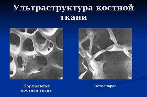 Поддержка костной системы и предотвращение остеопороза