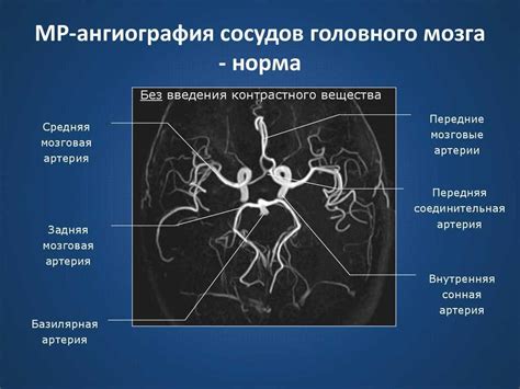 Показания и противопоказания для ангиографии