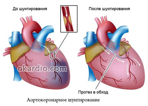 Полезный эффект на сердце и сосуды